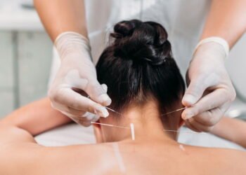 Acupuntura: entendendo a prática milenar