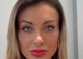 Andressa Urach procedimento para alterar cor dos olhos