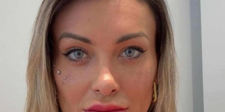 Andressa Urach procedimento para alterar cor dos olhos