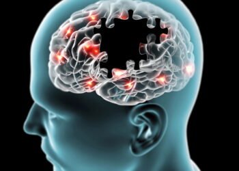 Doença de Parkinson