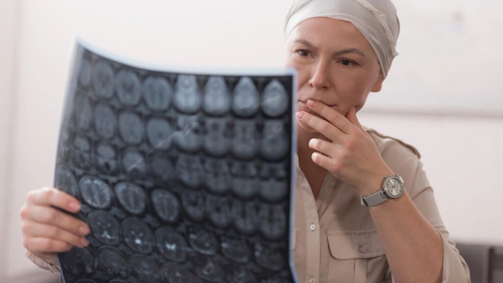 Diagnóstico do câncer