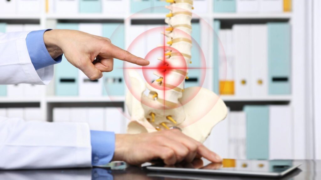 Hérnia de disco