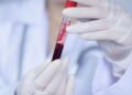 Os prós e contras de ter sangue Rh Nulo — Por que menos de 50 pessoas no mundo possuem esse tipo raríssimo?