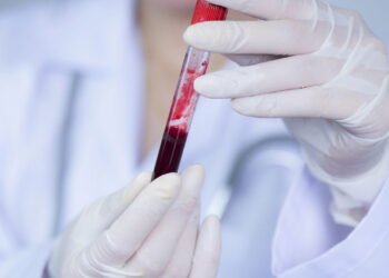 Os prós e contras de ter sangue Rh Nulo — Por que menos de 50 pessoas no mundo possuem esse tipo raríssimo?