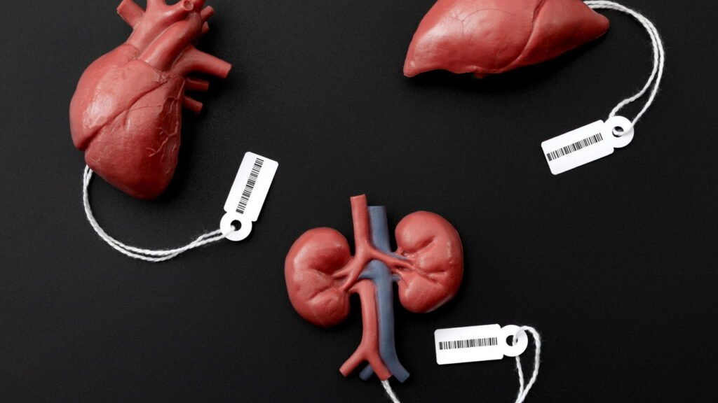 Transplante de órgãos