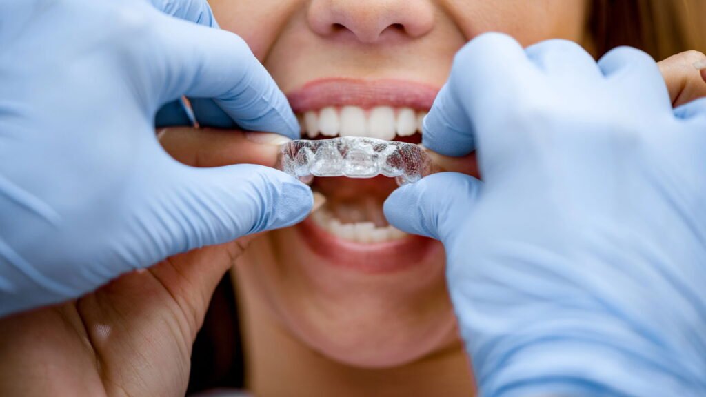 Aparelho ortodôntico