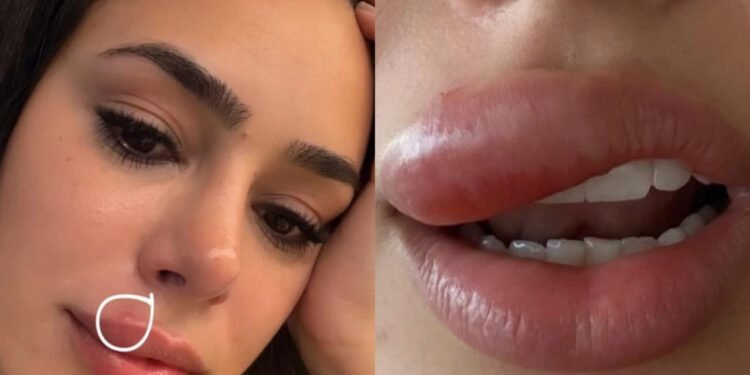 Bruna Biancardi revela celulite facil - Reprodução/Instagram