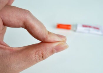 Colou os dedos com supercola? Saiba o que fazer com segurança