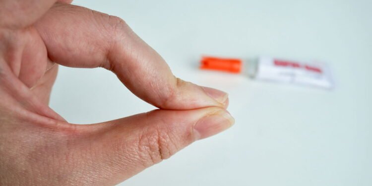 Saiba o que fazer se colar seus dedos com supercola - depositphotos.com / Amandalamsyah