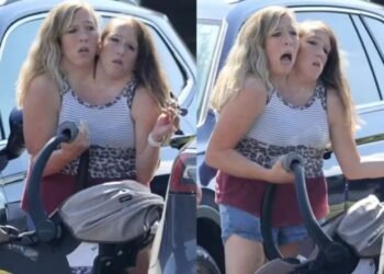 Gêmeas siamesas com bebê