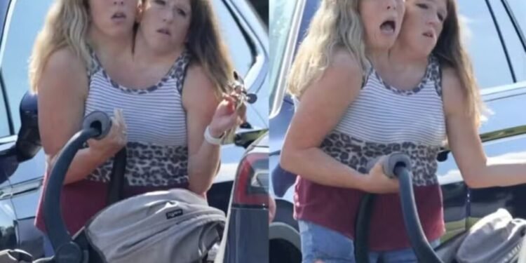 Gêmeas siamesas com bebê