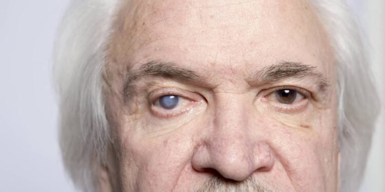 Afinal, existe perigo em operar os dois olhos da catarata ao mesmo tempo?