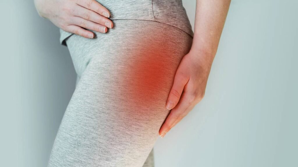 Síndrome do piriforme