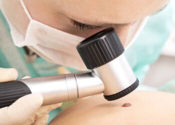 Inteligência Artificial detecta câncer de pele agressivo com 94,5% de precisão