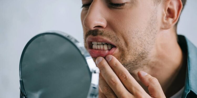 Sonhar com dentes caindo: o que a psicologia explica