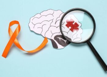 Novo exame pode antecipar diagnóstico da esclerose múltipla em até 7 anos