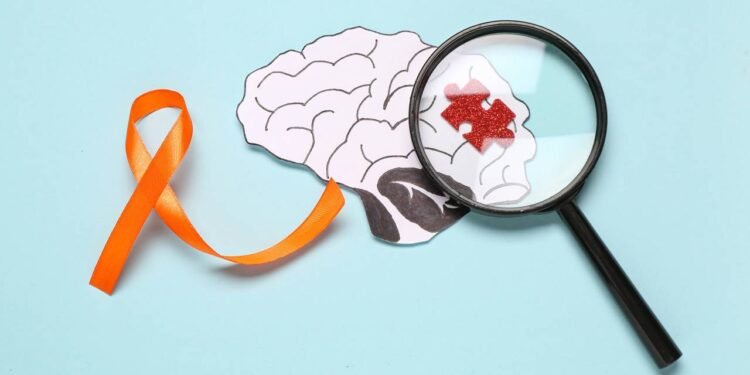 Novo exame pode antecipar diagnóstico da esclerose múltipla em até 7 anos