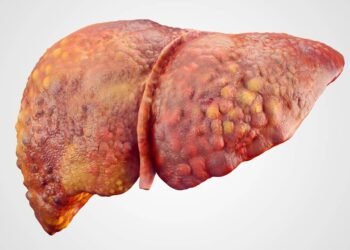 Por que pessoas magras também podem ter gordura no fígado? Entenda