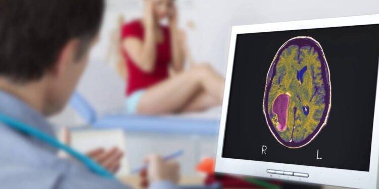 Veja os sintomas que podem indicar tumor cerebral, segundo neurologista