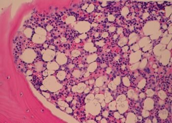 Fungo provoca surto com mortes nos EUA e gera pânico; saiba qual é