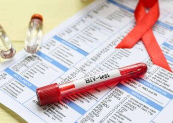 Fiocruz testa injeção semestral contra HIV em sete cidades