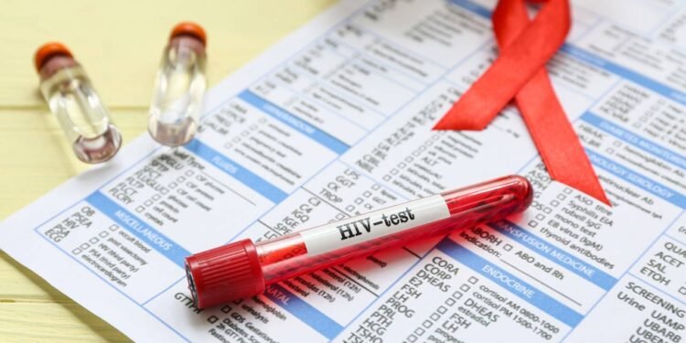 Fiocruz testa injeção semestral contra HIV em sete cidades