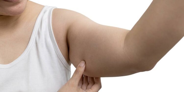 Flacidez após uso de caneta emagrecedora; saiba como evitar