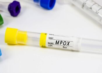 Vírus da Mpox evolui e autoridades emitem alerta