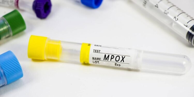Vírus da Mpox evolui e autoridades emitem alerta