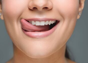 Clareamento dental caseiro: saiba os riscos e o que não fazer