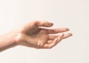 Fim do Carnaval: saiba os truques para tirar o glitter do corpo