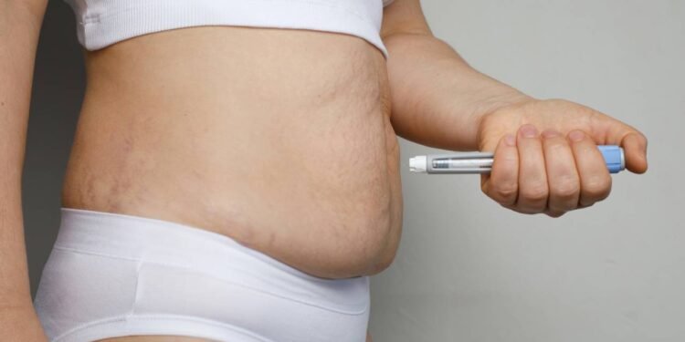 Médicos alertam risco de pancreatite em quem usa canetas emagrecedoras