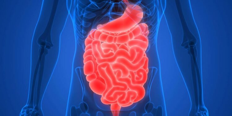 Você sabe o que é a síndrome do intestino irritável? Saiba os sintomas
