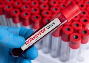 Afinal, quais são os sintomas da mpox? Saiba reconhecê-los!