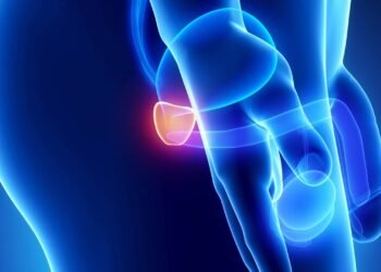 Especialista alerta para sinais do câncer de próstata