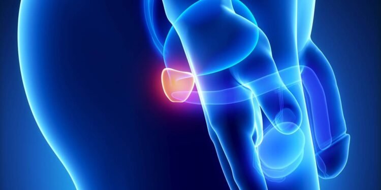 Especialista alerta para sinais do câncer de próstata