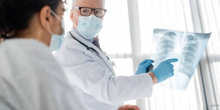 Os principais sintomas de câncer de pulmão, segundo oncologistas