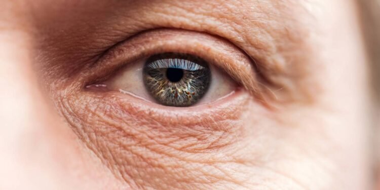 Afinal, tomar colágeno realmente evita o aparecimento de rugas?