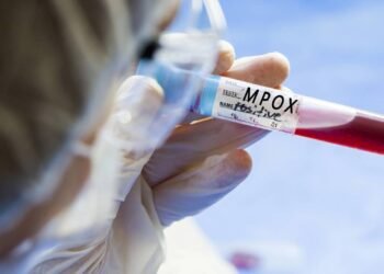 Mpox: como diferenciar os sintomas dos de outras doenças de pele?