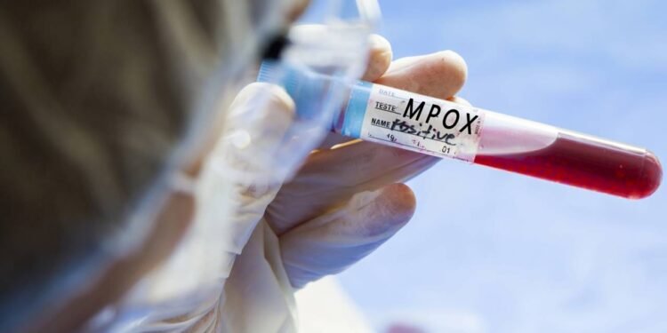 Créditos: depositphotos.com / flashback313@gmail.com