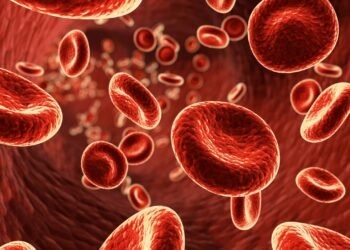 Anemia pode ser o 1º sinal de câncer de intestino