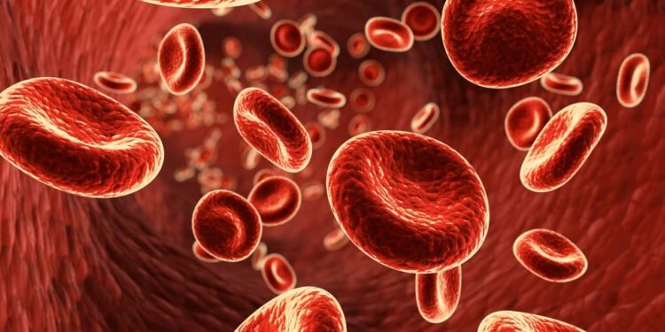 Anemia pode ser o 1º sinal de câncer de intestino
