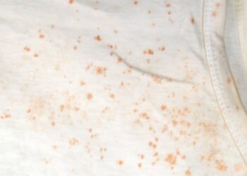 Mofo no guarda-roupa: saiba como proteger suas roupas