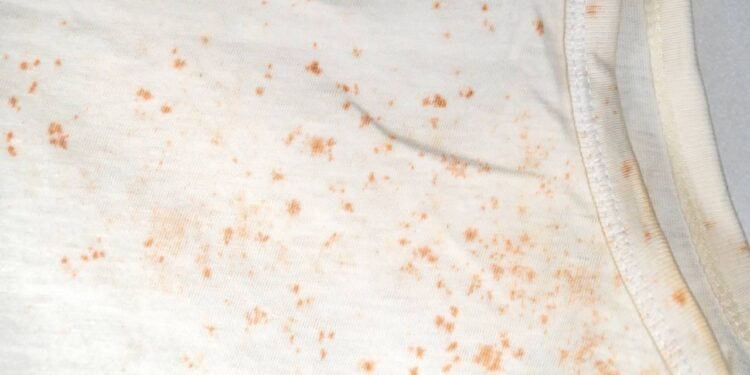 Mofo no guarda-roupa: saiba como proteger suas roupas