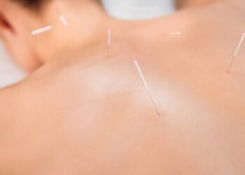 Acupuntura ajuda a controlar a fome: mito ou verdade?