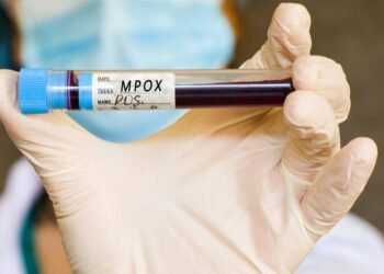 Como prevenir e reconhecer os sintomas iniciais da mpox