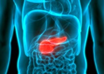 Câncer de pâncreas: 7 sinais silenciosos para se atentar