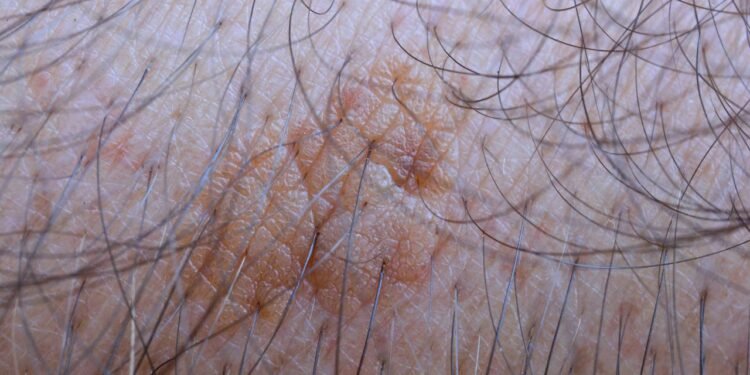 Créditos: depositphotos.com / fotocodp