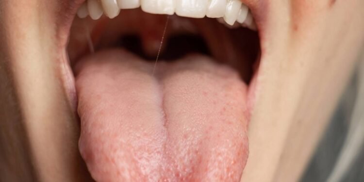 Créditos: depositphotos.com / vikabest88@gmail.com