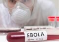Surto de Ebola em 2026: onde está, sintomas e como se proteger